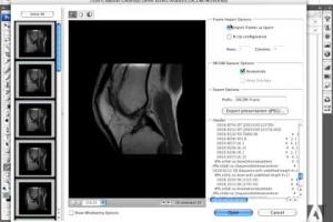 Mastering DICOM Files: Open with Free Viewers & Photoshop